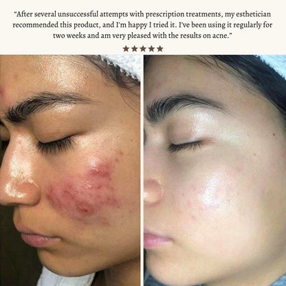 Radiant Pulse™ - High-Frequency Therapy Wand