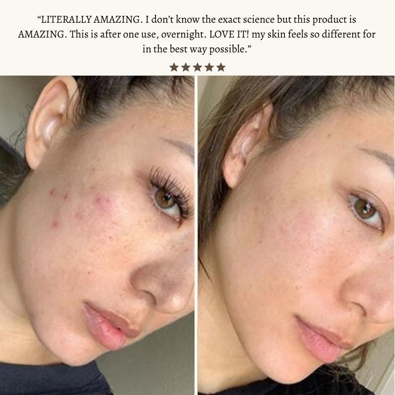 Radiant Pulse™ - High-Frequency Therapy Wand