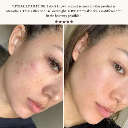 Radiant Pulse™ - High-Frequency Therapy Wand